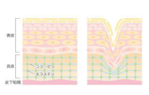 つくば市「エンビロンパートナー店」シワ・たるみにお悩みの方